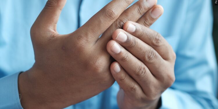 PCH now offers external beam radiation therapy, new hope for arthritis sufferers